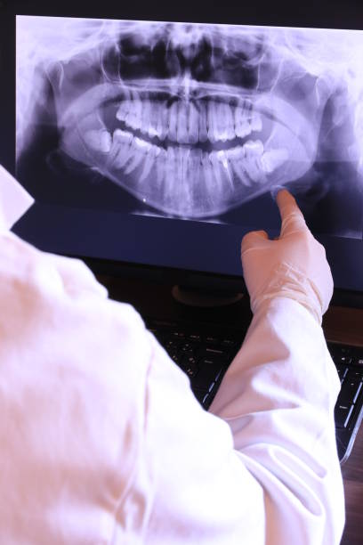 Best Chipped Tooth Repair Near Me  in Mayfair, CA